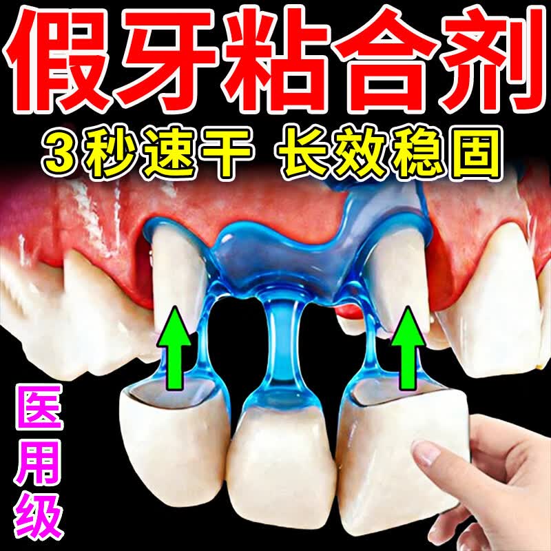 假牙烤瓷牙粘合剂医用牙胶全瓷牙冠牙齿义齿固定粘接剂专用强力胶 顶配款【800%不脱落】全套工具 三甲医院同款永久稳固