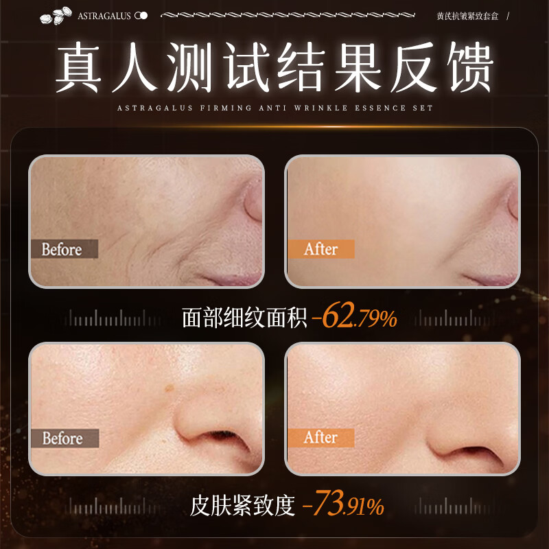 黄芪霜官方旗舰店正品送礼礼物抗皱紧致淡化细纹补水保湿滋养套装新升级 六件套【全方面套装】