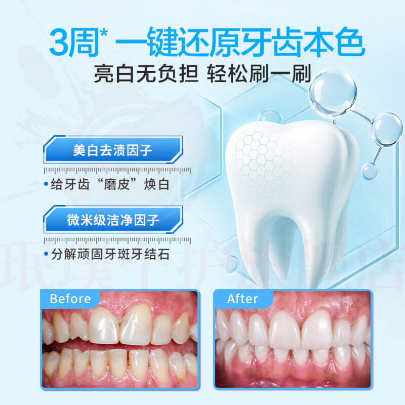 思亚希sasd牙膏正品艾思达牙膏SASD清新口气焕白去渍牙膏口臭美白抗敏感 一支装【体验装】 官方自售