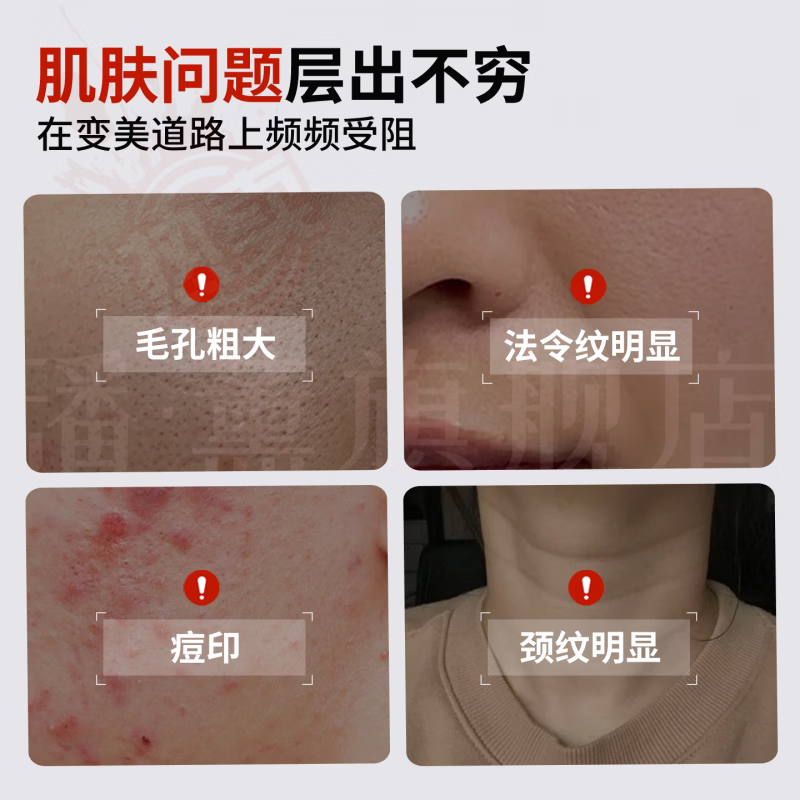 蔷姗qhy护理膜胶原蛋白敷料细致毛孔淡化纹路痘印提亮暗沉去黑色素 5盒装【重度反复症状】 官方直售