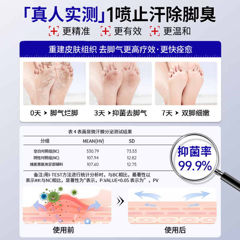 Vendvia脚气喷剂止痒脱皮烂脚丫真菌感染脚臭脚痒改善足部抑菌喷雾剂 【第二瓶半价】去脚气脚臭克星