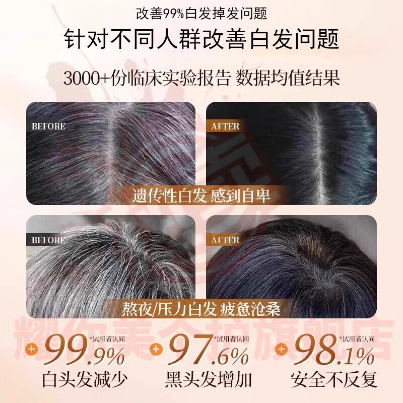 鹿角卉素可园维生素b黑发滋养白发黑发藏红花首乌养发精华睡眠贴 3盒装【中度症状适用】 官方直售