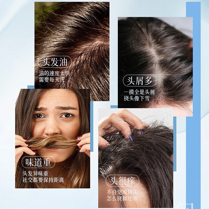 BEIYVS爱茉博士去屑洗发水二硫化硒清屑止痒控油蓬松持久留香清洁头皮 3瓶【长期修护 头屑0反复】 【官方直售 京质保障】