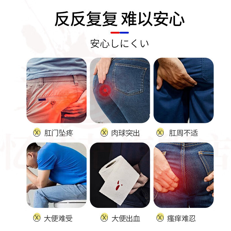 MRYU奥乐思特医用痔疮膏外用软膏肉球肛门肿胀疼痛瘙痒内外混合断 五支装 重度肛裂便血拍3发5 官方自售