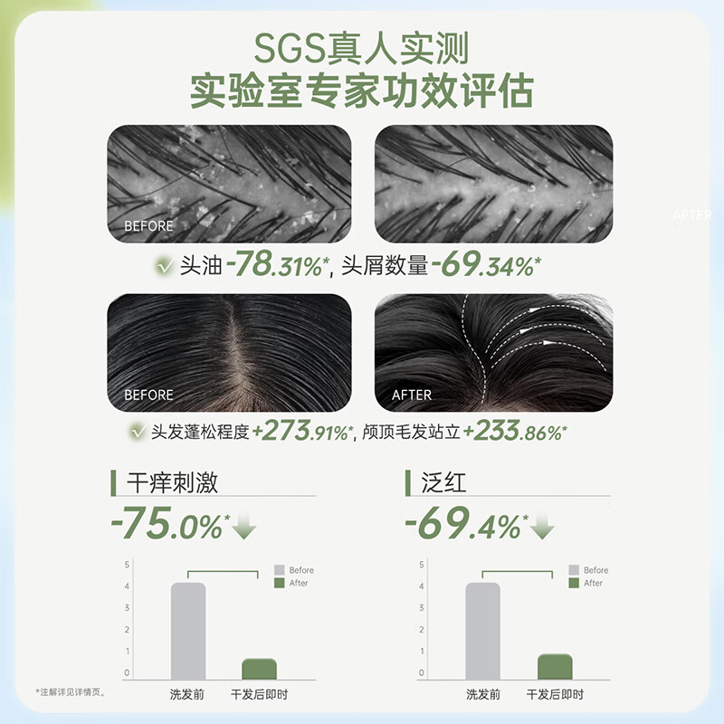 袋鼠妈妈青少年洗发水去屑控油清爽蓬松柔顺修护洗发露男女孩学生洗护套装 【进阶去屑 】洗发水380ml