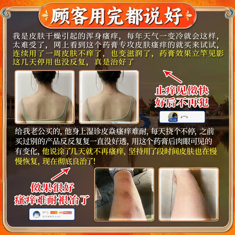 云南本草抑菌止痒膏皮肤瘙痒湿诊皮肤炎真菌感染外用全身皮肤手脚干痒杀菌 【快速止痒】1盒装 .