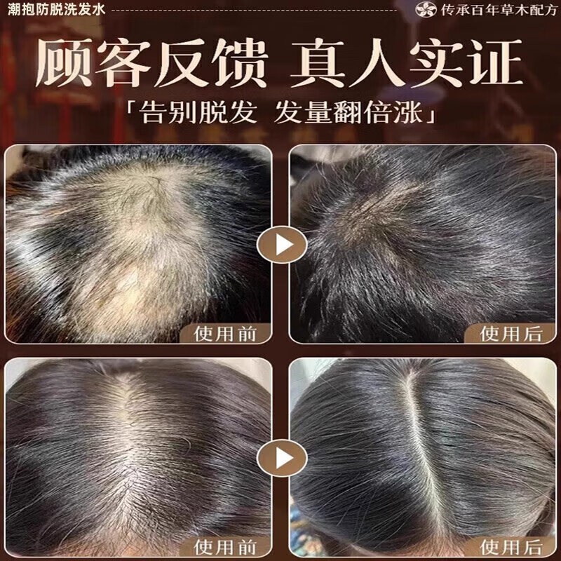胖东来同款生姜侧柏叶防脱育发洗发水纯中药固发养发增发控油蓬松 3瓶装针对重度脱发长出新发