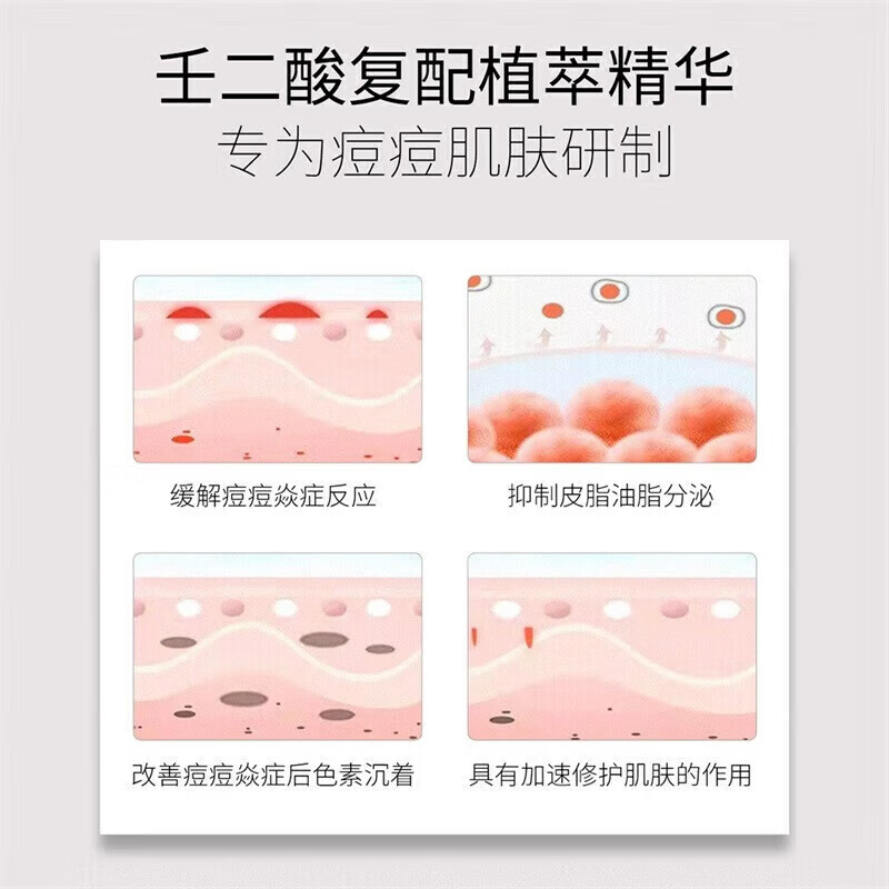 SKINOREN思丽安壬二酸20%乳霜水油平衡疏通毛孔改善肌肤保湿抗衰老修复 20%壬二酸乳霜 30g *1支