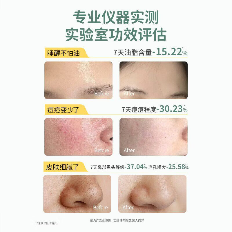 减荟袋鼠妈妈青少年洗面乳控油祛痘青春期男女孩去黑头专用儿医用 【祛痘焕亮组合】洗面乳+洁颜乳（到手7件）