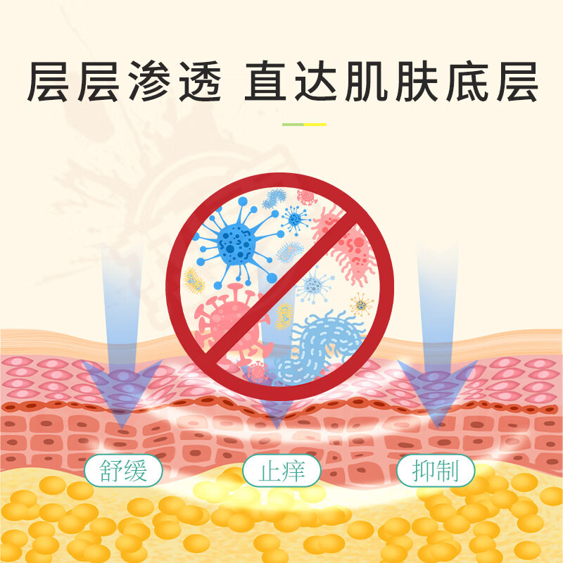 熏姿颜柏可芬软膏湿疹膏皮肤止痒外用顽固皮炎阴囊肛门瘙痒汗泡疱疹药膏 1盒见效装 官方自售