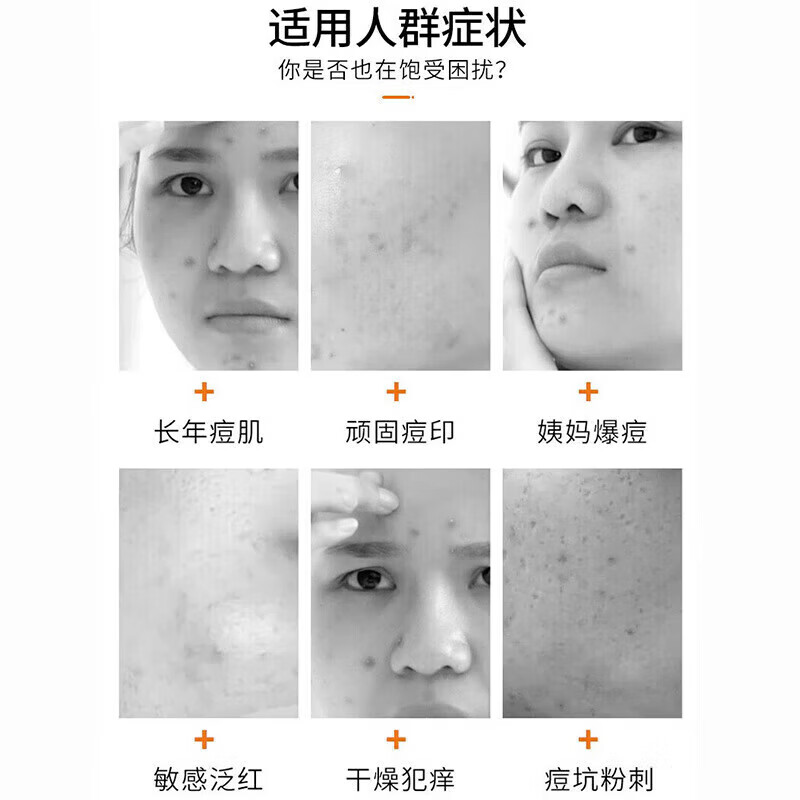 SKINOREN思丽安壬二酸20%乳霜水油平衡疏通毛孔改善肌肤保湿抗衰老修复 20%壬二酸乳霜 30g *1支