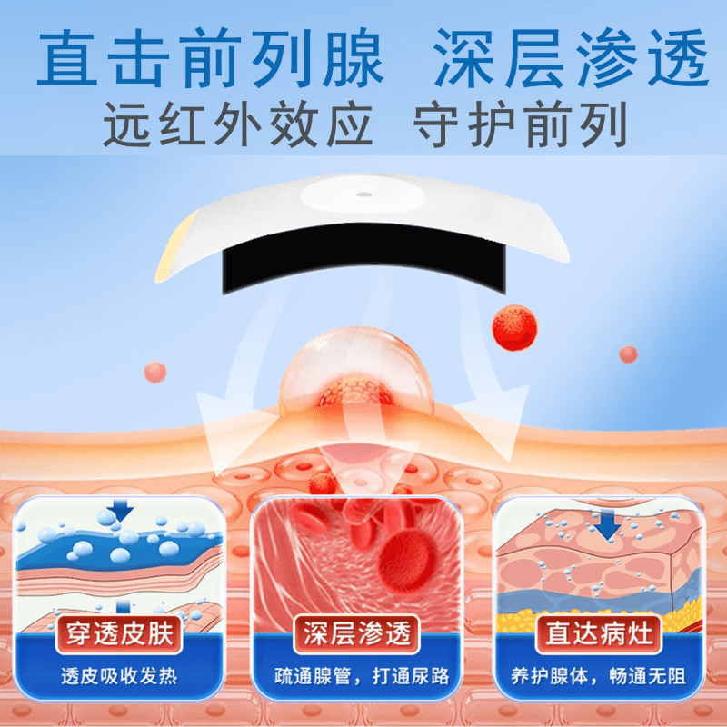 熏姿颜龙苓芝尿频尿急贴尿频尿不尽夜尿增多小便热敷贴医用穴位刺激 5盒 买3赠2【巩固装】 【官方旗舰京质保障】