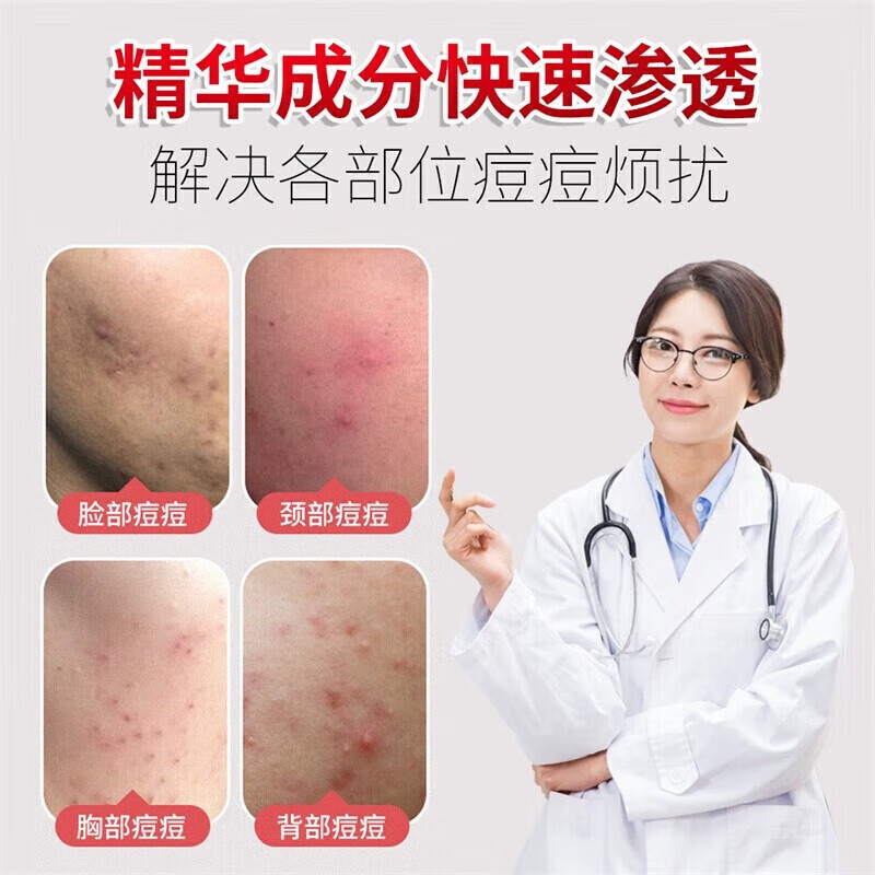 SKINOREN思丽安壬二酸20%乳霜水油平衡疏通毛孔改善肌肤保湿抗衰老修复 20%壬二酸乳霜 30g *1支