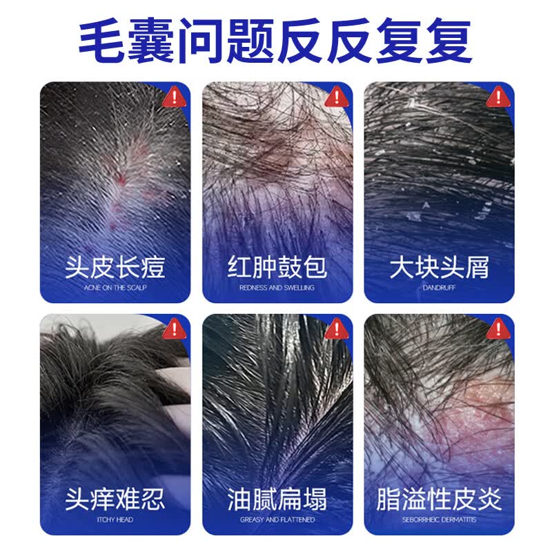 葵花医用洗发水重组胶原蛋白头部护理敷料毛囊炎状脂溢性皮炎头皮止痒 【毛囊炎症 溢脂性头皮】 1瓶240ml
