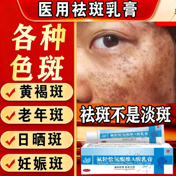 MRYU氟轻松氢醌维a乳膏医用祛斑黄褐斑雀斑官方正品改善面部色素沉淀 5盒装 官方直售