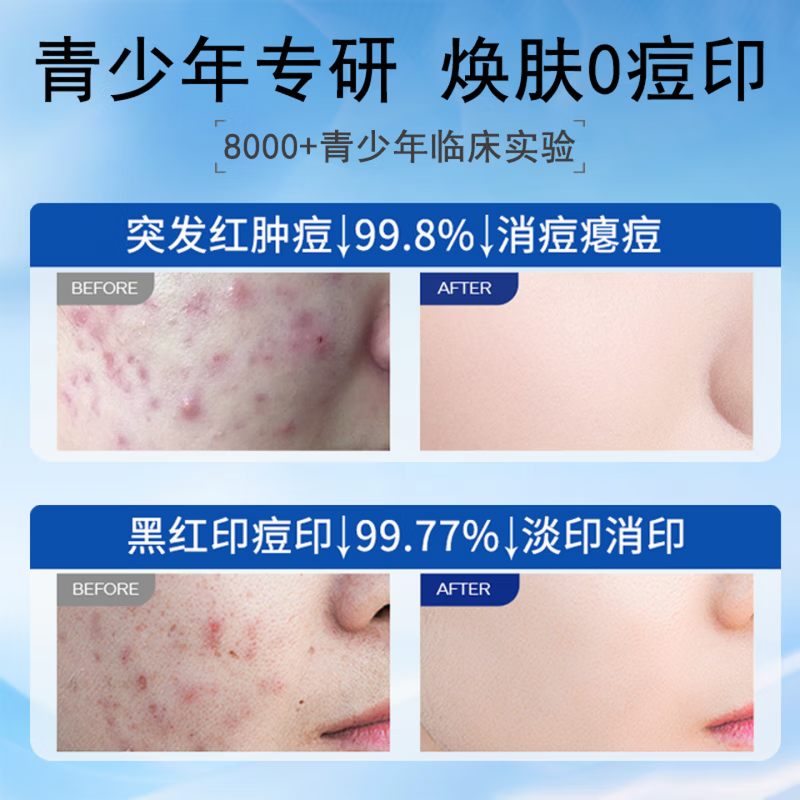 梦若羽eak祛痘凝胶【官方直售】淡化痘印去豆痘坑闭口粉刺青春痘痘黑头 【99%的顾客选择】买三赠二 5支装 【官方旗舰 京质保障】