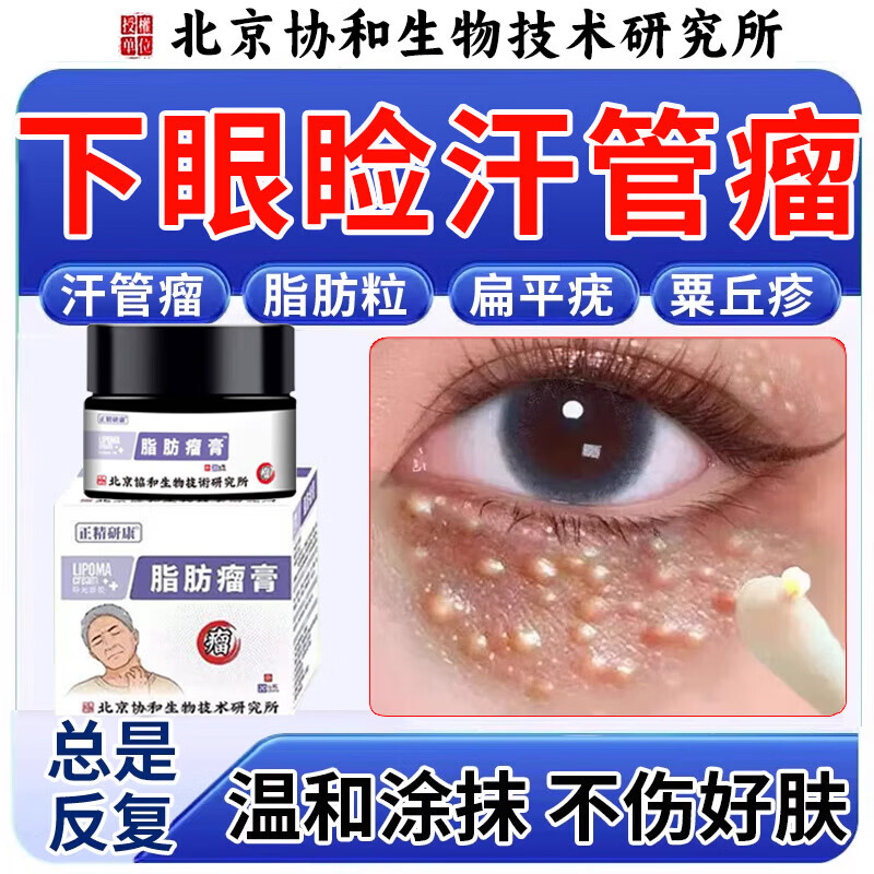 茹念眼部汗管瘤脂肪粒专用膏搭药膏去除��器扁平疣栗丘疹眼周家庭护理 单盒体验装[送棉签]眼周汗管瘤