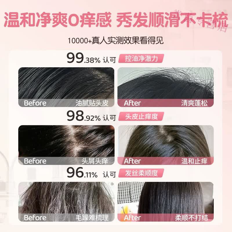 MRYU流迷儿童温和洗发水儿童洗发水无添加纯植物3-16岁专用青少年去屑 【洗沐套装】洗发水308ml+沐浴露308ml