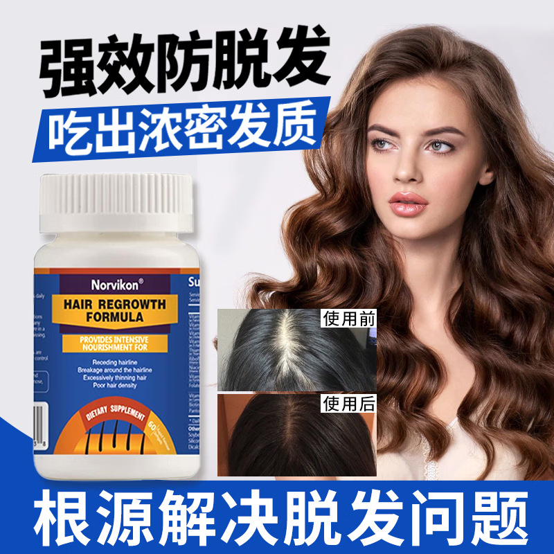 norvikon美国进口生物素防脱发掉发白发复合多种维生素b7b6胶囊生发CL 解决脱发白发发量浓密 60粒*3瓶 京东折扣/优惠券