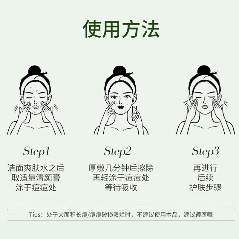 熏姿颜积雪草苷凝乳膏胶法痘痘印去痘坑痘疤修复淡化凝胶精华液消印 5支 买3赠2【巩固装】 【官方旗舰京质保障】