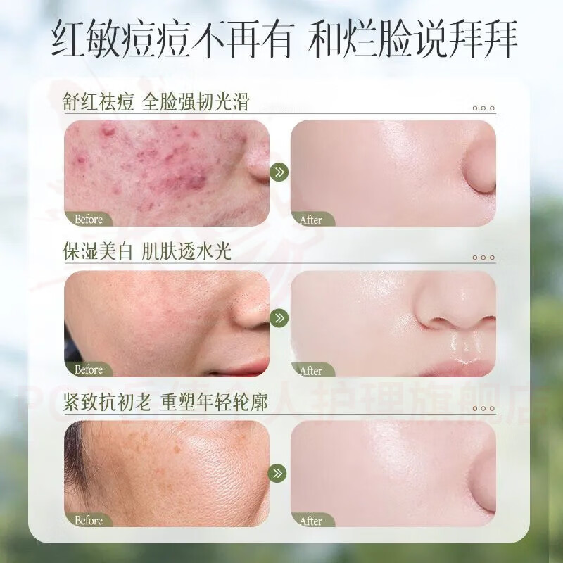 岳倩雅吕积雪草水乳保湿乳提亮护肤套装清爽型修护补水控油保湿舒缓水 积雪草舒缓保湿水+乳 官方自售