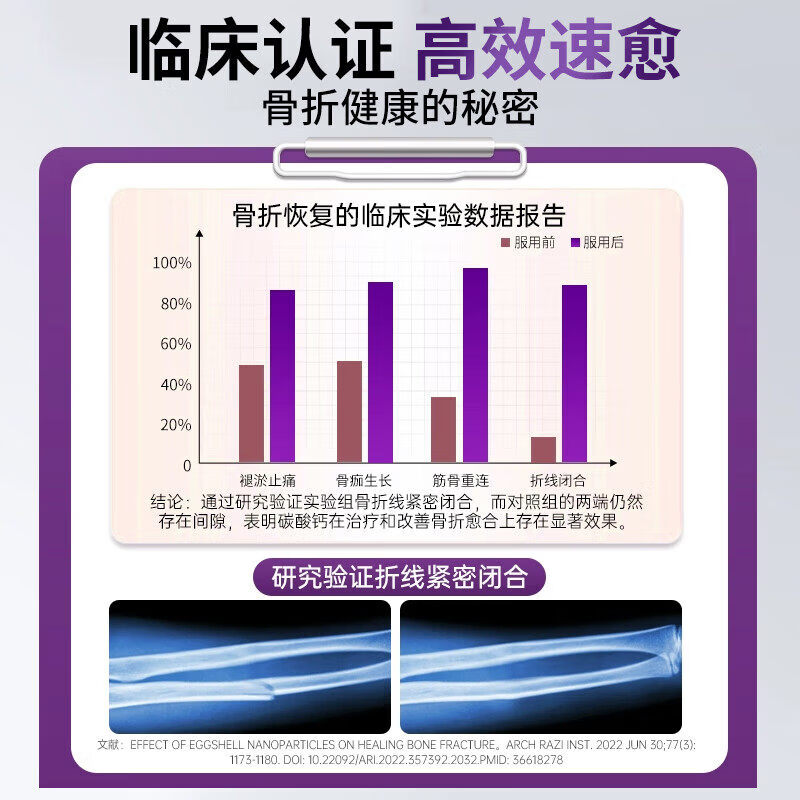 钙尔奇（Caltrate）中老年人钙片碳酸d3片紫钙韧骨精华强韧骨骼骨裂恢复钙片含维生素 120片*3瓶