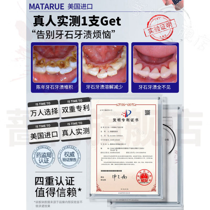 御妙春奥齿伶抗牙结石牙膏去黄去渍美白去口臭口气重嘴巴臭清洁牙齿正品 3支装【巩固护理反复】 官方直售