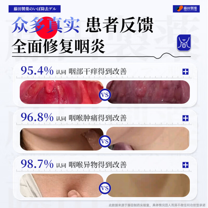 BEIYVS复方福可定口服溶液慢性咽炎化痰嗓子喉咙干痒干咳异物感喷剂 5瓶巩固装【不易反复】 【官方直售】