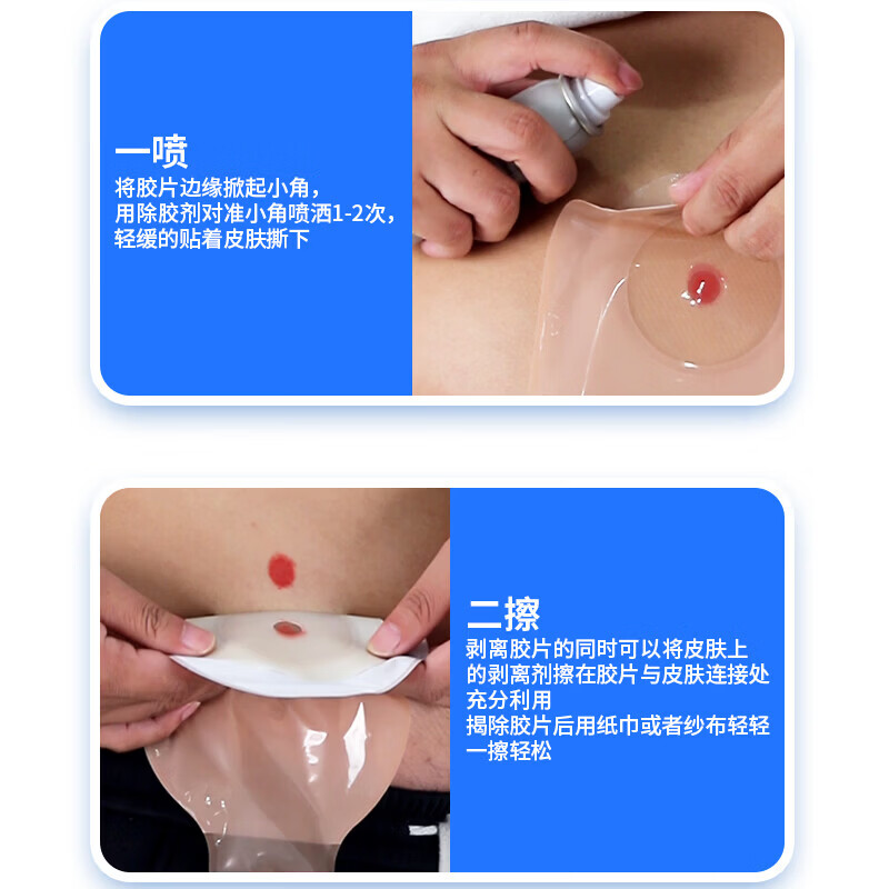 康复之家造口护理用品造口底盘黏胶剥离喷剂膏药黏胶剥离喷剂 60mL 造口底盘黏胶剥离喷剂H04C 60mL
