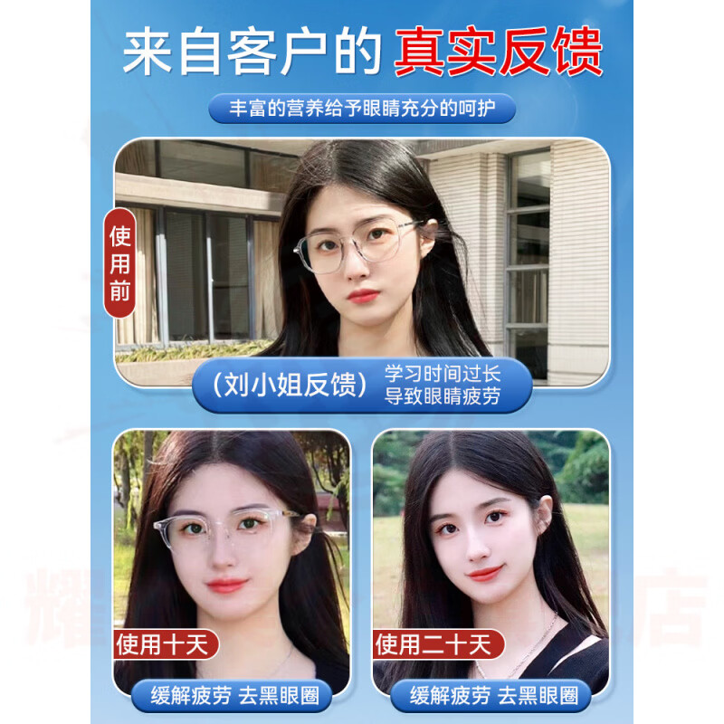 鹿角卉捷裕臻清目亮眼贴眼缓解视疲劳改善视力儿童叶黄素青少年 5盒装【重度反复症状】 官方直售