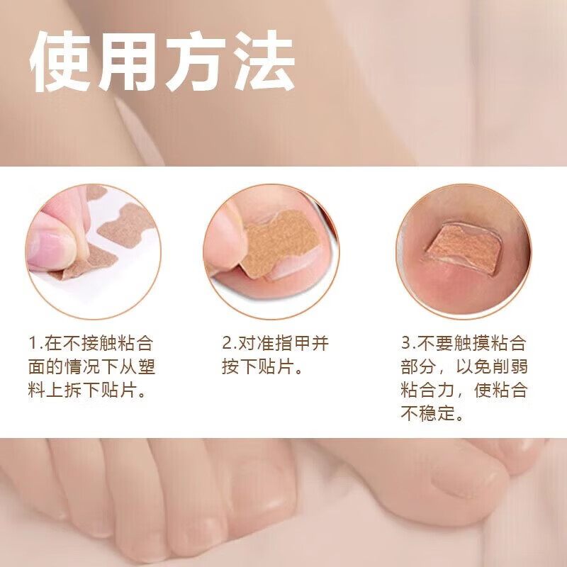 ZYUO甲沟炎器贴片脚指甲长肉里专用正甲贴片甲沟嵌甲器趾甲
100贴【品质保障】 无痛矫正 不再扎肉
