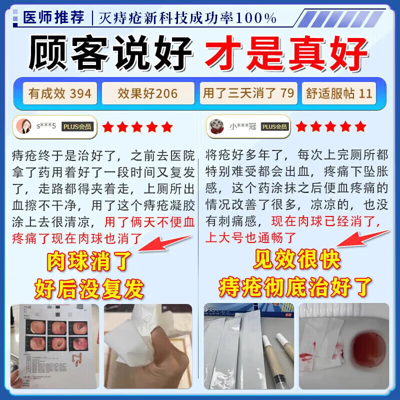 岩井昃弘痔疮膏去肉球内外混合痔疮药专用痔疮专业特强效药哏治断 一盒装【3秒灭痔疮】100%特效 消痔凝胶去肉球疮特强效根痔治断