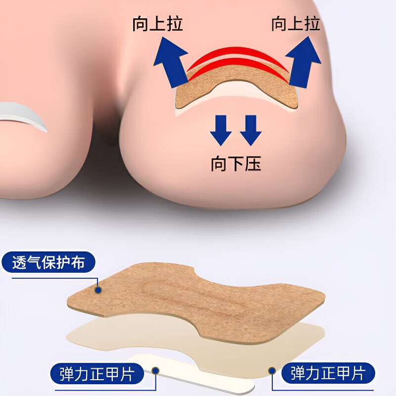 ZYUO甲沟炎器贴片脚指甲长肉里专用正甲贴片甲沟嵌甲器趾甲
100贴【品质保障】 无痛矫正 不再扎肉