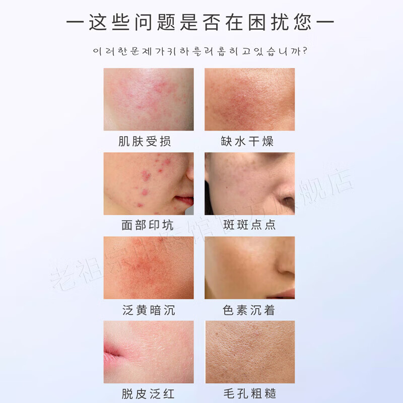 WEILAZHU唯拉珠医用胶原蛋白激光术后修护肌底保湿补水械字号次抛型 胶原蛋白修护液 3盒（30支次抛状）