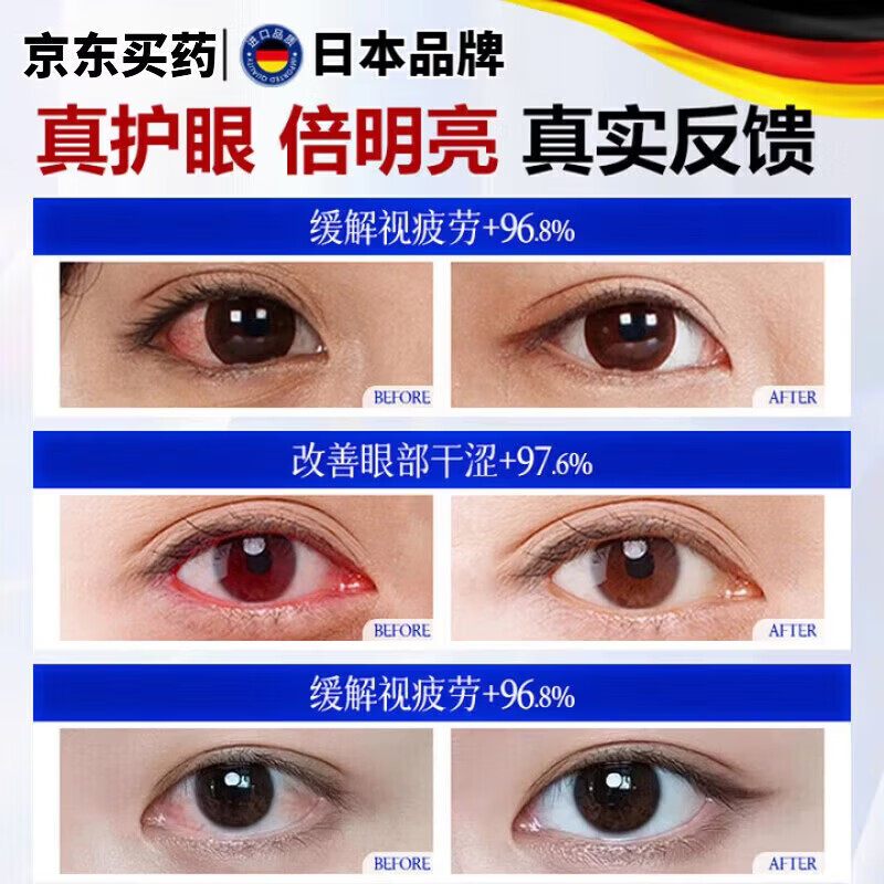 LUJAHA素滴眼液日本进口抗真菌感染结膜炎睑炎眼睛红肿红血丝
1盒【改善装】疲劳干涩 【官方直售】
