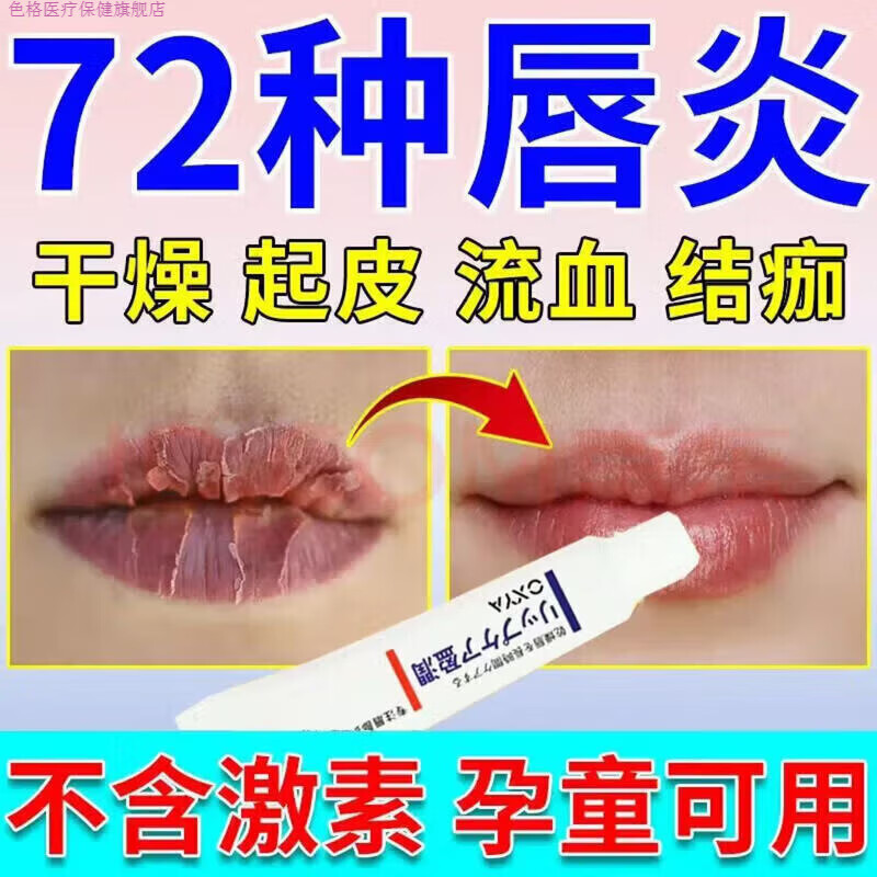 色格家庭护理麦美舒修复润唇膏唇炎唇部护理去死皮淡化唇纹防干裂保湿 一支装