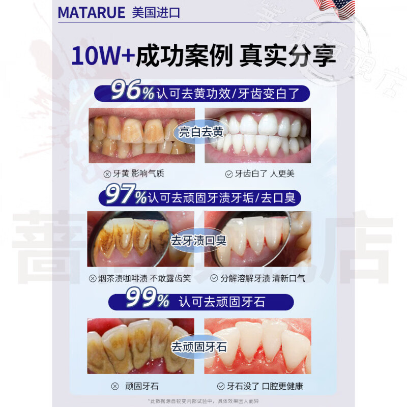御妙春奥齿伶抗牙结石牙膏去黄去渍美白去口臭口气重嘴巴臭清洁牙齿正品 3支装【巩固护理反复】 官方直售