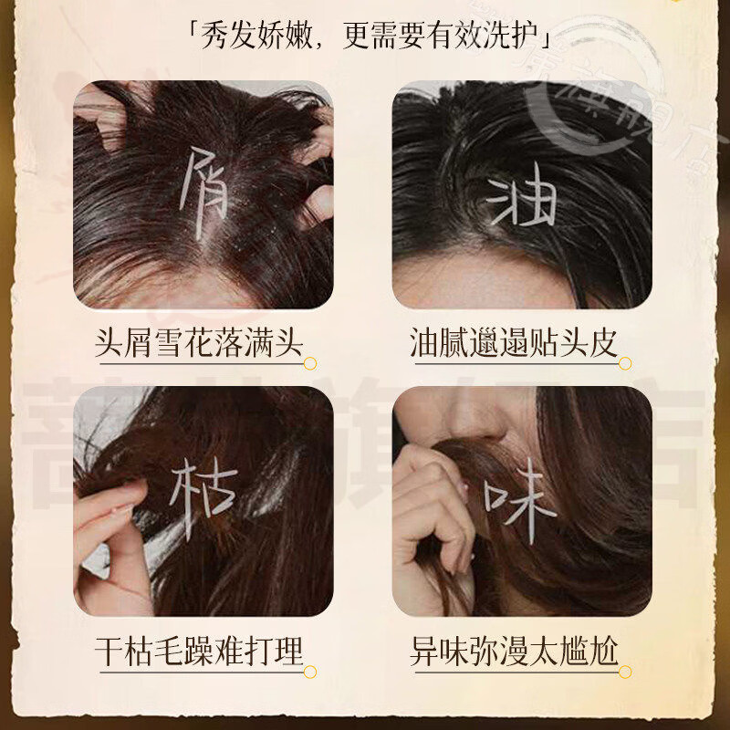 御妙春倾倾颜硫磺洗发水去屑止痒头皮毛囊头清洁控油蓬松持久清爽官方 5瓶【控油不干】囤货装 官方直售