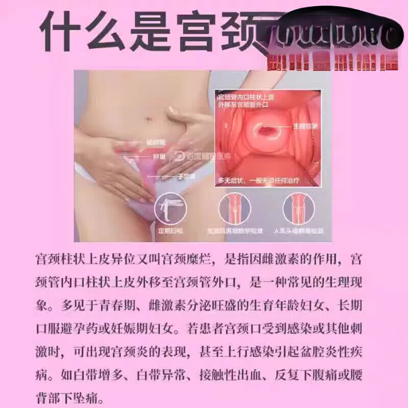 瑾芈康妇芙凝胶6支装健兴3支装妇科外阴瘙痒专用身体护理 三盒周期装