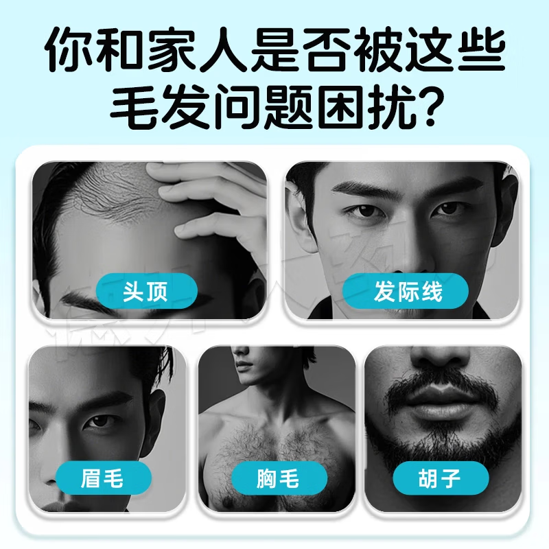 [惯爱]米诺地尔搽剂 5%*60ml 1盒装 官方正品米诺地尔5%男士专治脱发高效防脱生发育发斑秃发际线增长液搽剂清爽不油腻 体验装清爽不油腻