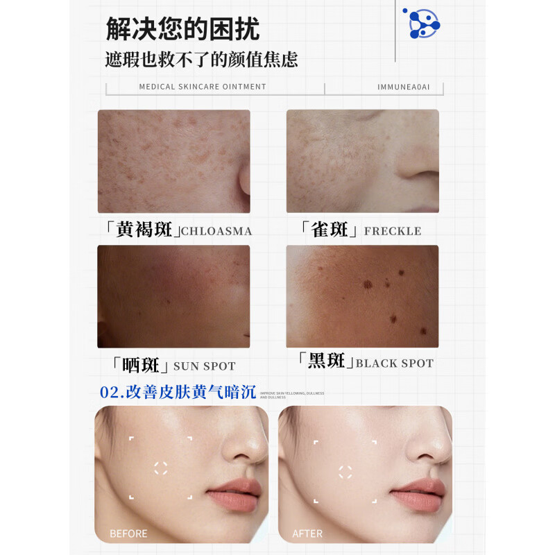 熏姿颜bwp祛斑凝胶美白淡化黑色素去黄褐斑色斑老年斑提亮肤色改 2支【院线同款 官方自售