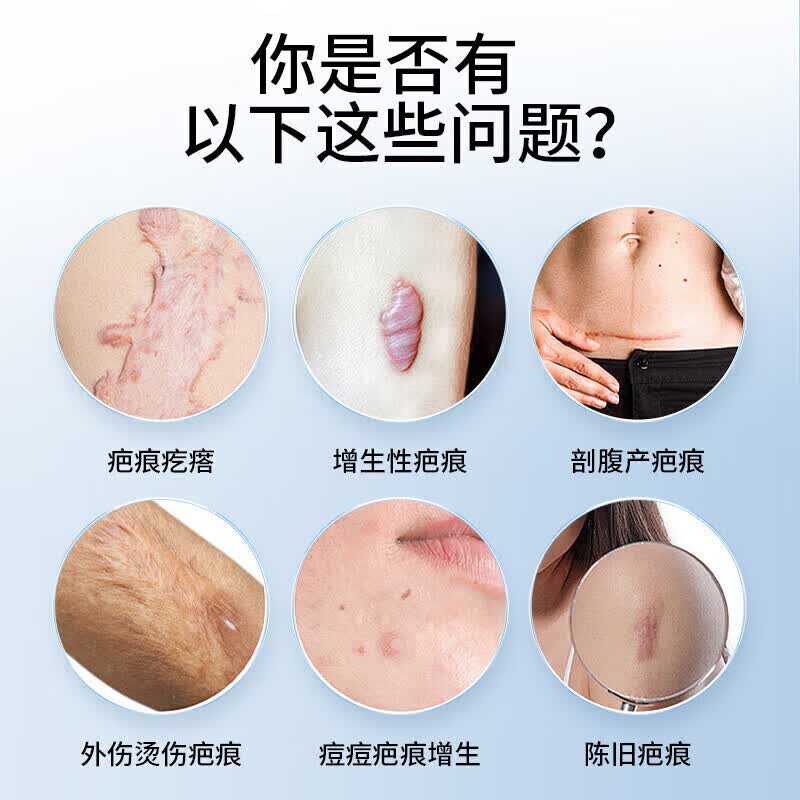 邦院长医用祛疤膏祛疤痕专用修复灵剖腹产烧烫伤增生手术缝针去疤痕凝胶 2盒周期装【轻微疤痕适用】