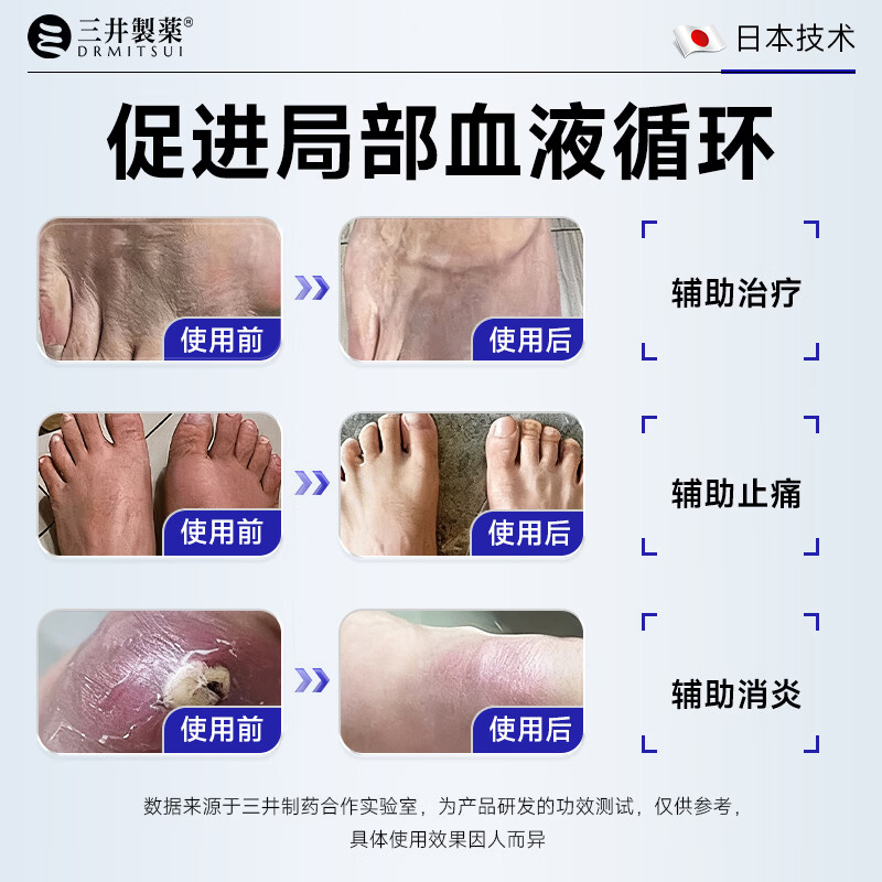 三井制药痛风远红外骨痛冷敷凝胶贴治疗尿酸去结晶关节止痛30克 3支装赠2支【巩固装】适合尿酸600-800患者