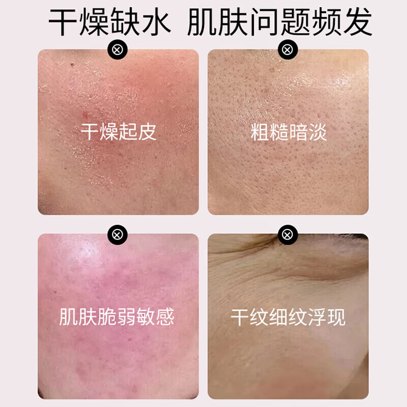 薇诺娜(WINONA)极润补水保湿水乳护肤品套装敏感肌可用化妆品女生日礼物母亲节 6件套:洁面+水+乳+精华+面霜+眼霜