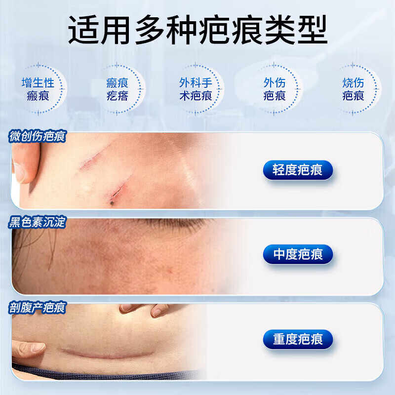 邦院长医用祛疤膏祛疤痕专用修复灵剖腹产烧烫伤增生手术缝针去疤痕凝胶 2盒周期装【轻微疤痕适用】