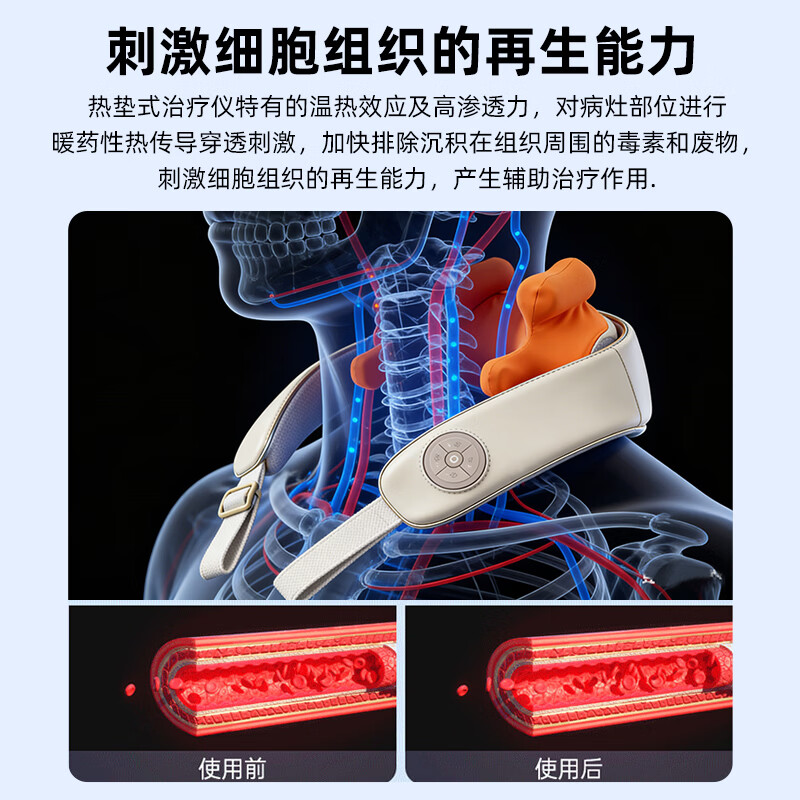 康立普（CANLIPE）颈椎按摩仪肩颈热敷理疗电动仿真人手颈椎专用疏通神器揉捏按摩器 颈部热垫式治疗仪+【艾绒包*18盒】