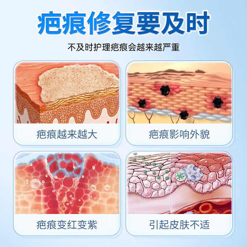 邦院长医用祛疤膏祛疤痕专用修复灵剖腹产烧烫伤增生手术缝针去疤痕凝胶 2盒周期装【轻微疤痕适用】