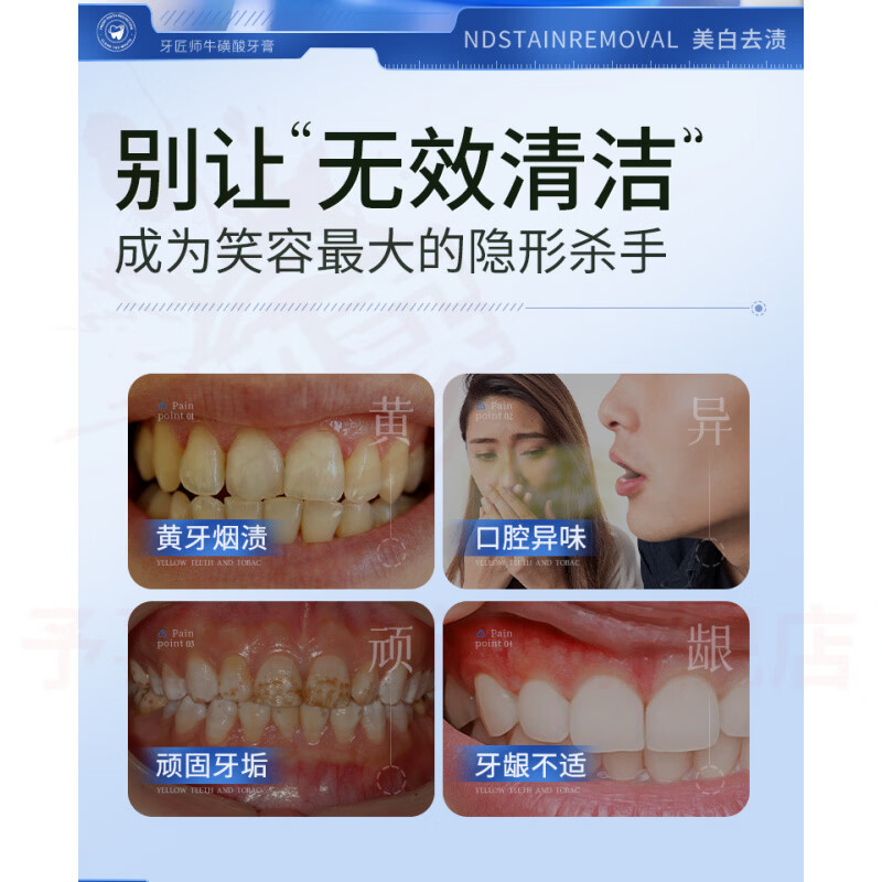 鹿角卉倾倾颜美白牙膏去黄去渍结石牙垢改善口臭清新口气焕亮洁白护龈固 五支装 【全家呵护】 官方自售