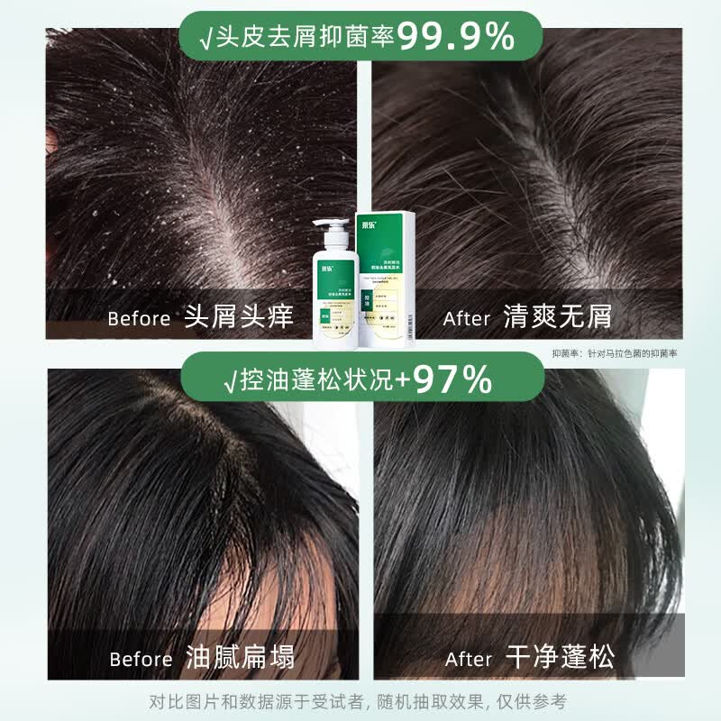 采乐去屑洗发水茶树去屑止痒控油蓬松头皮深层清洁抑菌洗发露洗头膏 【96%人回购】去屑净油油洗发水