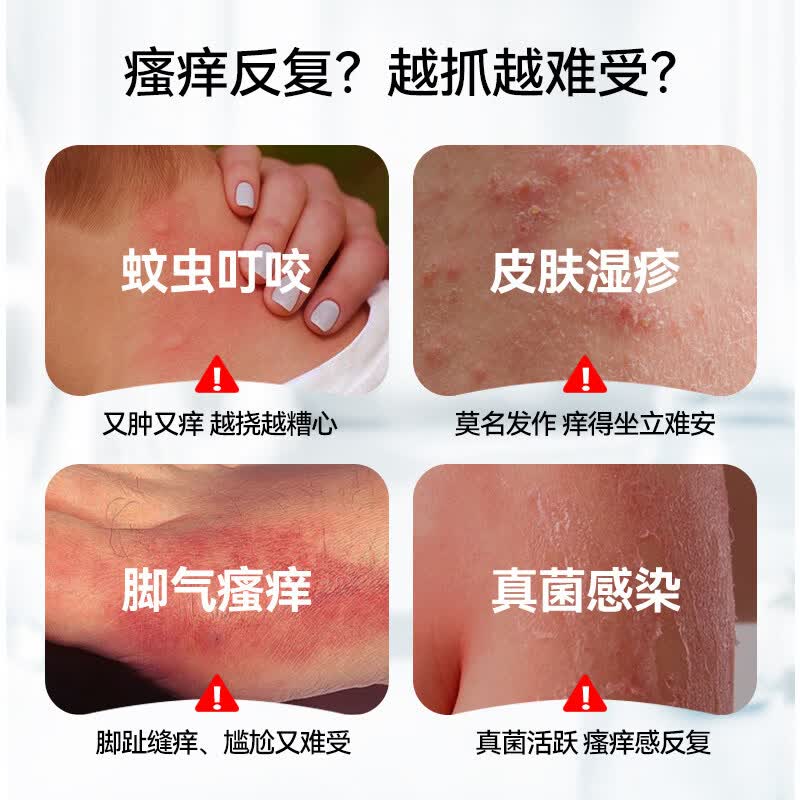 通用LAPOR断痒王皮肤瘙痒干痒止痒软膏全身痒温和抑菌B 20g 全身止痒断痒王20g